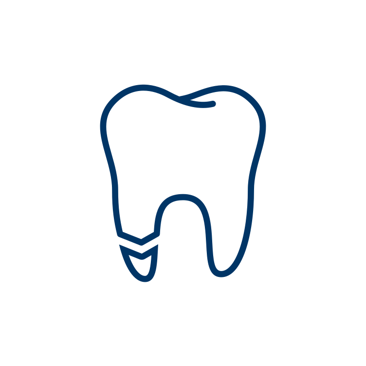 Dental Bondings Dental Bondings