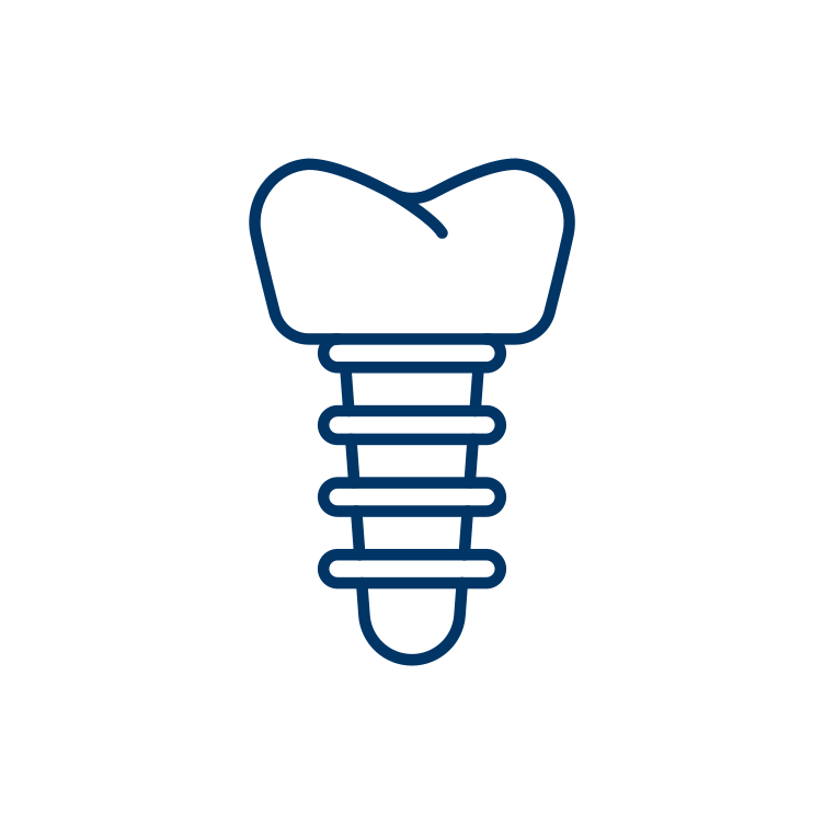 Implant Restoration Implant Restoration
