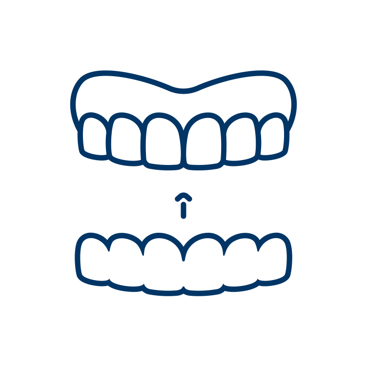 Clear Aligners Clear Aligners
